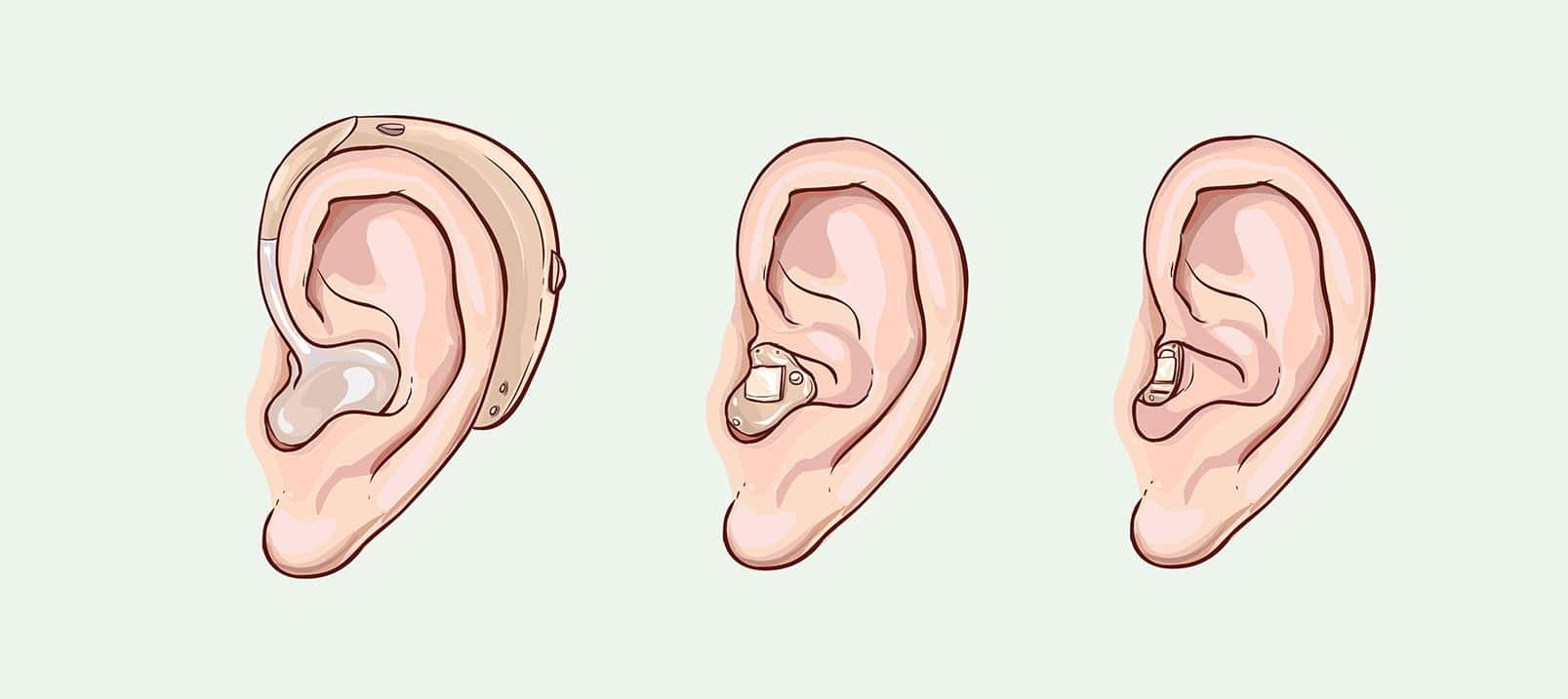 remboursement protheses auditives